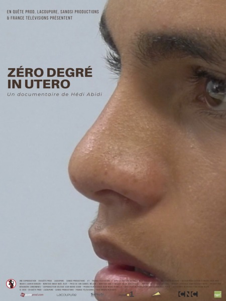 Zéro degré in utero Zéro degré in utero